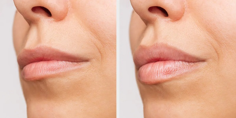 Safe and Effective Solution for Unwanted Hair